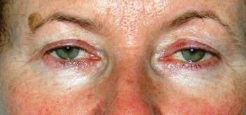 Dr. Popescu Daniel - Chirurgie plastica