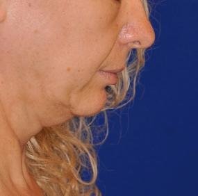 Dr. Popescu Daniel - Chirurgie plastica